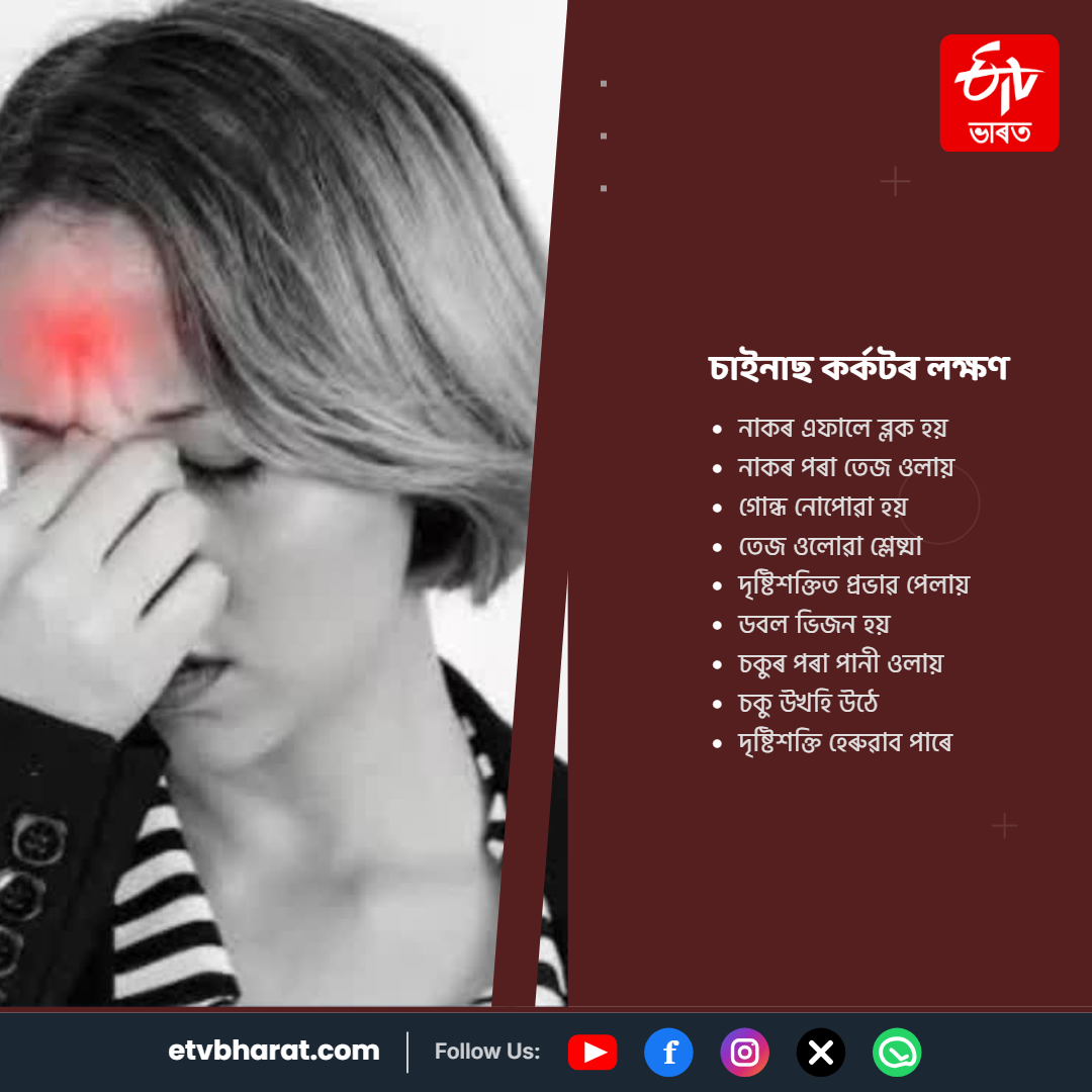 Know about the nasal cancer