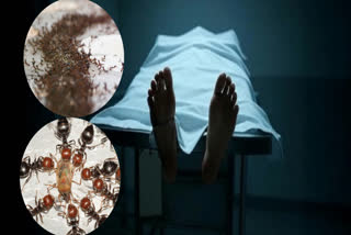 PHARMACOTHERAPY  MYRMECOPHOBIA DISEASE  MYRMECOPHOBIA SYMPTOMS  ANXIETY DISORDER