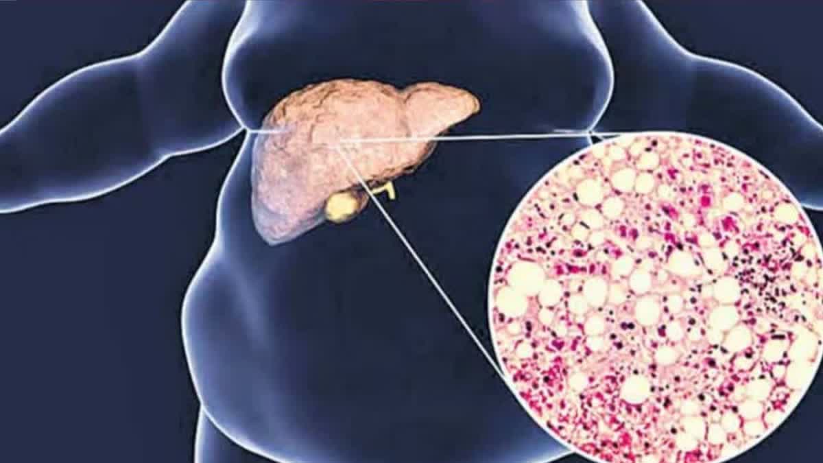 FATTY LIVER PATIENTS NOT EAT