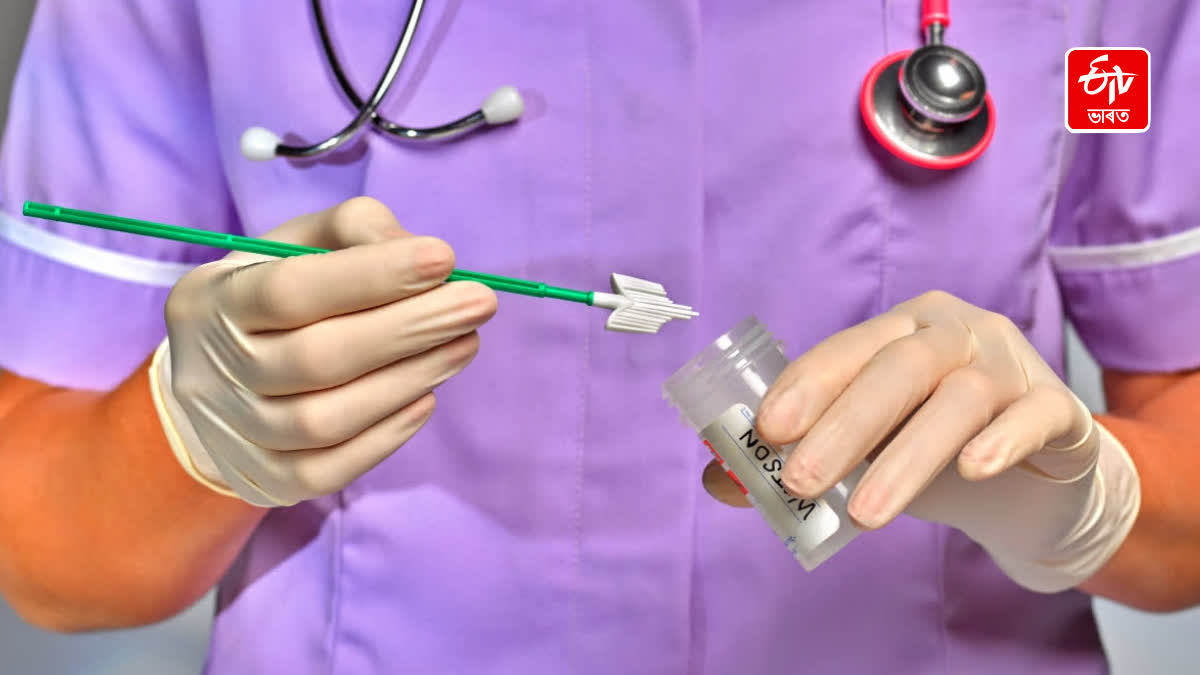 SEXUALLY TRANSMITTED INFECTIONS