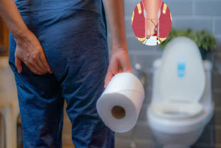Home remedy for piles