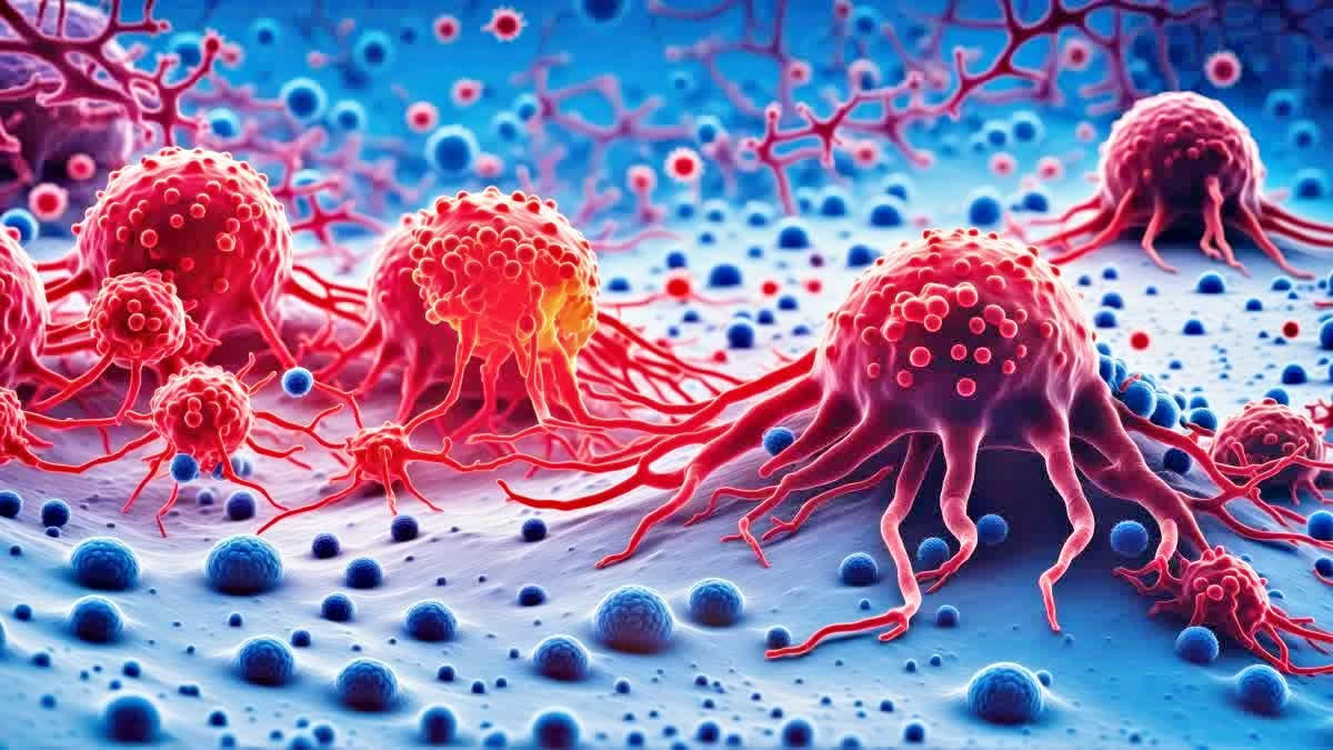 Representational Image.