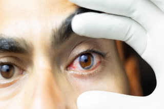 DAILY HABITS THAT DAMAGES EYES  SCREEN TIME AFFECTS EYES  HOW TO INCREASE EYESIGHT  ದೈನಂದಿನ ಅಭ್ಯಾಸಗಳಿಂದ ದೃಷ್ಟಿಗೆ ಹಾನಿ