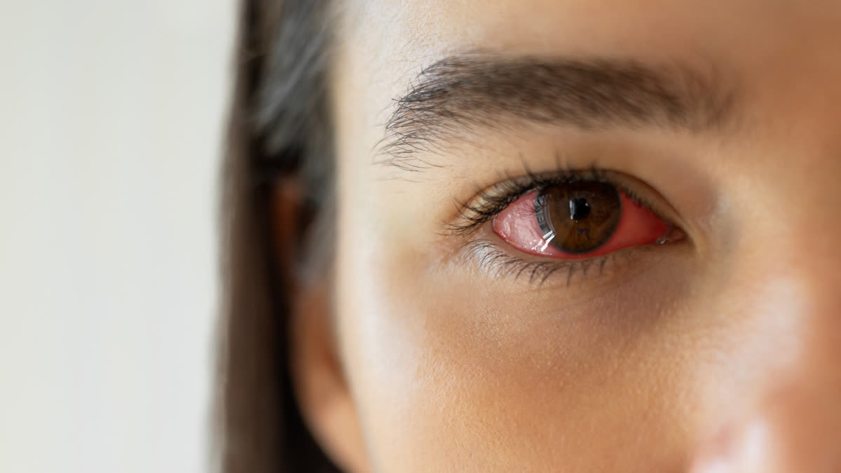 Early Warning Signs of Eye Diseases You Shouldn't Ignore