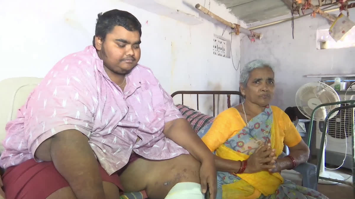 A Man Suffering From Over Weight