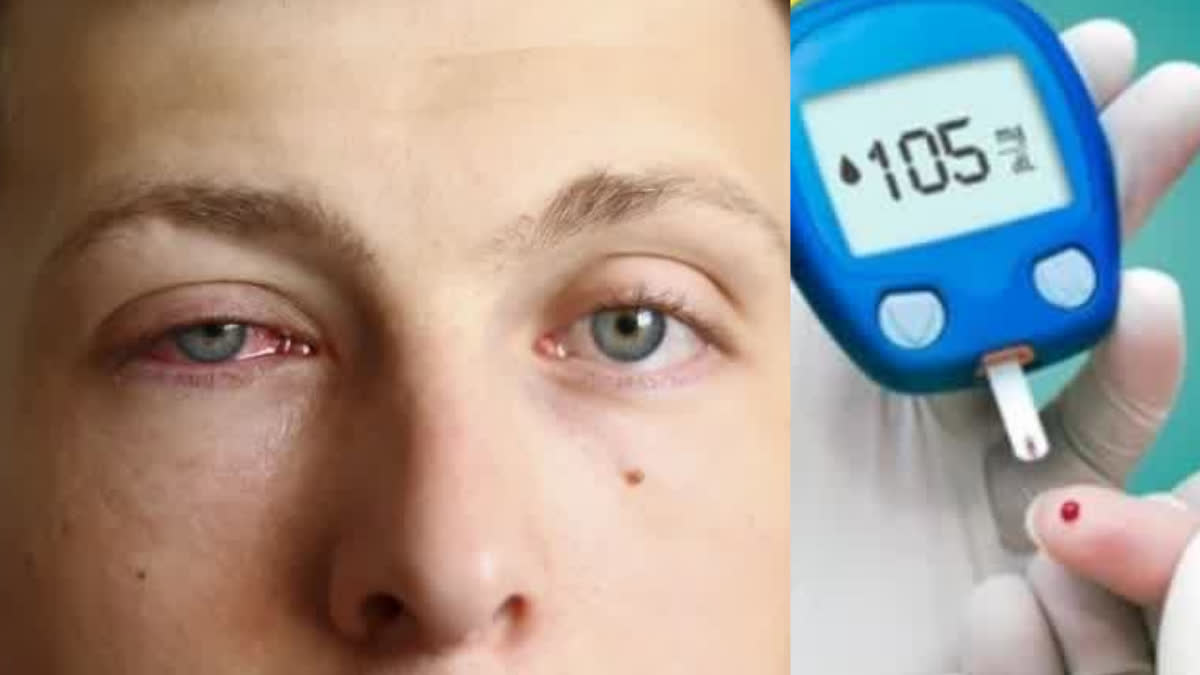 A visible sign in the eyes that your blood sugar is too high. Symptoms AND CAUSES of DIABETES
