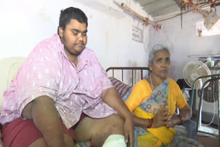 A Man Suffering From Over Weight