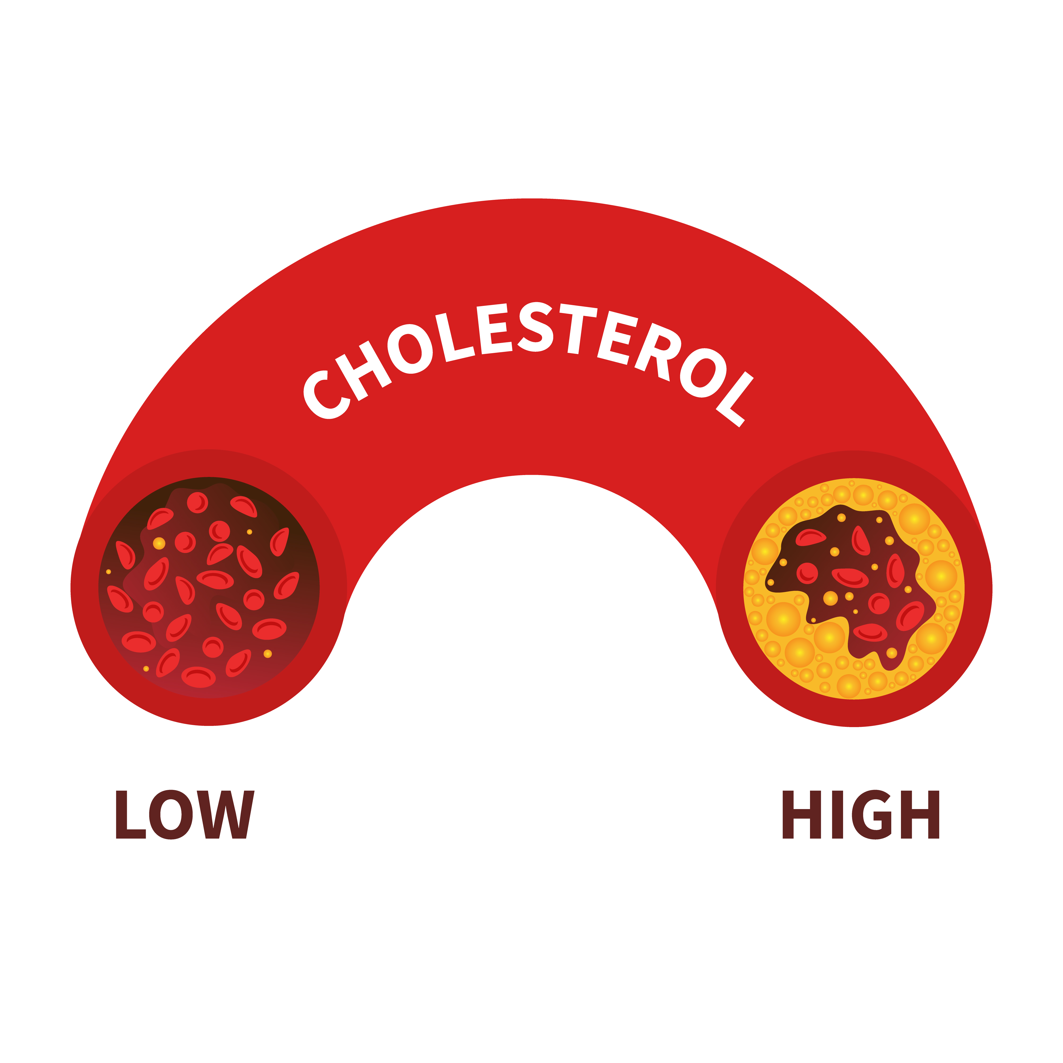 high cholesterol These vegetables lower cholesterol ಹೈ ಕೊಲೆಸ್ಟ್ರಾಲ್ ಕಡಿಮೆ ಮಾಡುವ ಆಹಾರಗಳು Protein rich foods