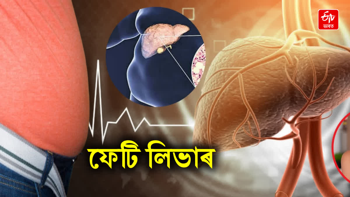 39 percent of adult Indians are affected by fatty liver