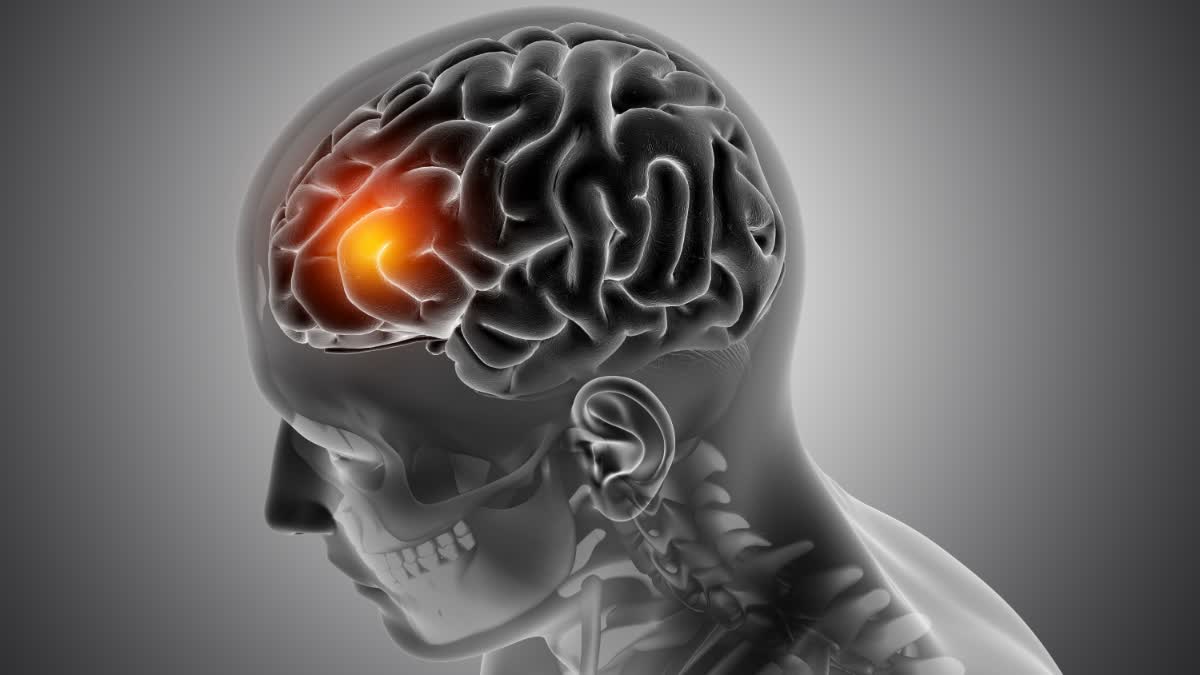 5 bad habits for brain health which can increase-risk of brain tumor