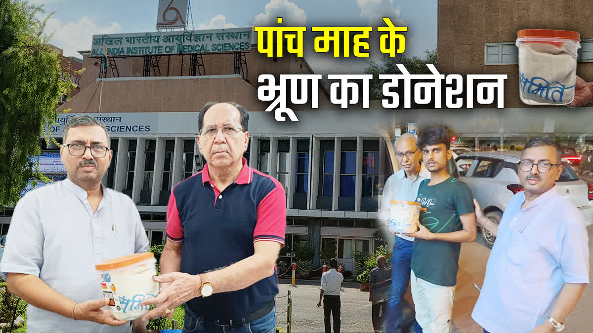 दिल्ली एम्स में पहली बार हुआ पांच माह के भ्रूण का डोनेशन
