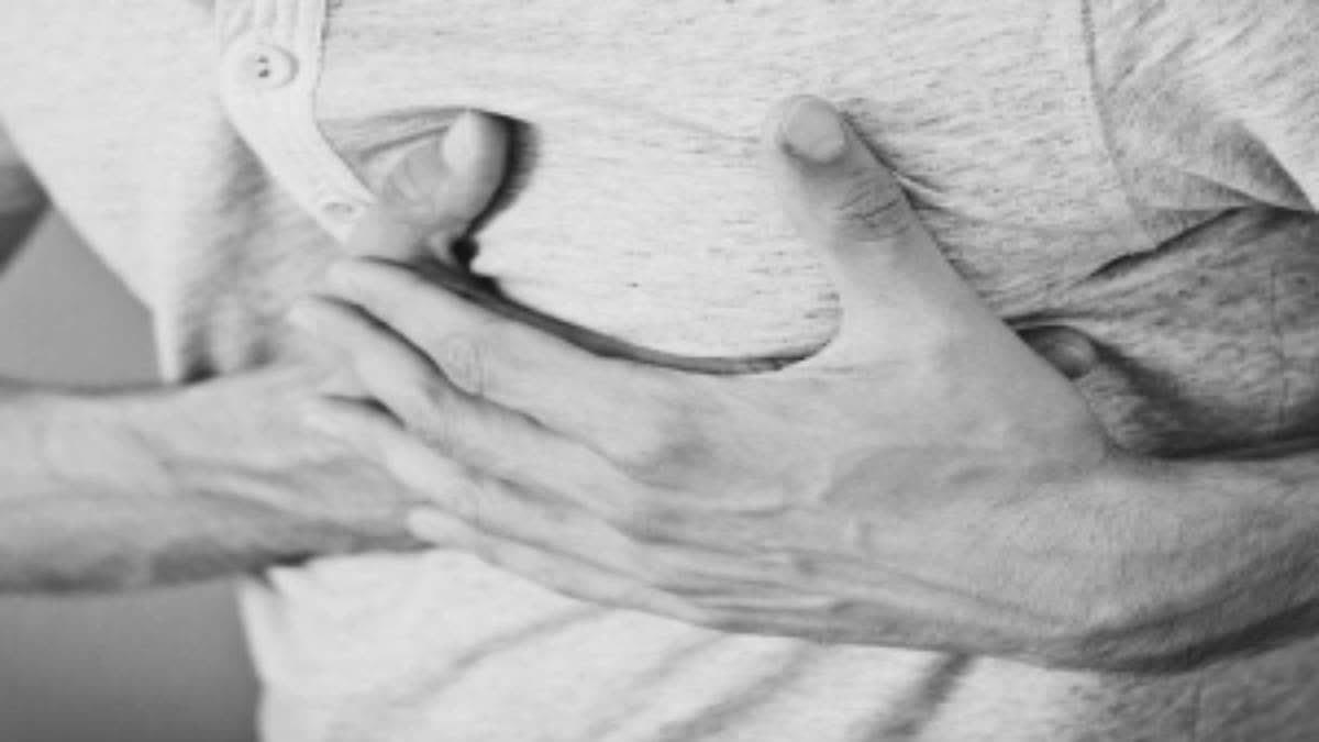 Representational Image.