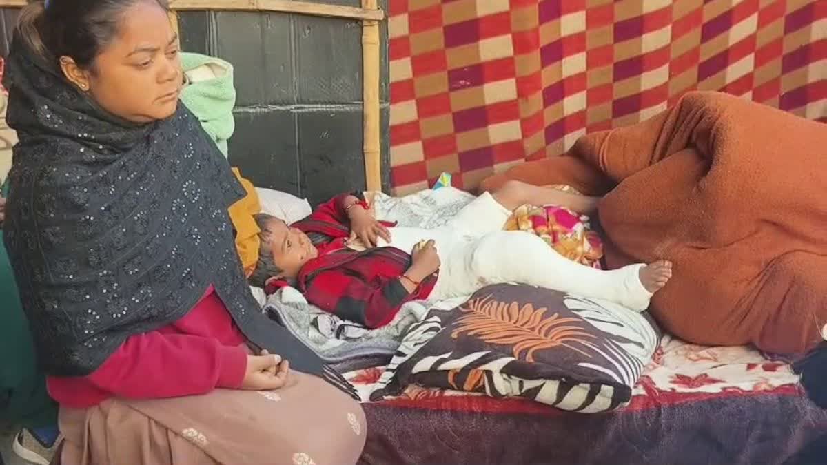 Dog bites to children