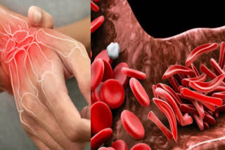What are the symptoms of poor blood circulation in the body and what are its causes?