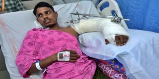 Rare Surgery First in Aiims Grafted Severed Hand in Mangalagiri