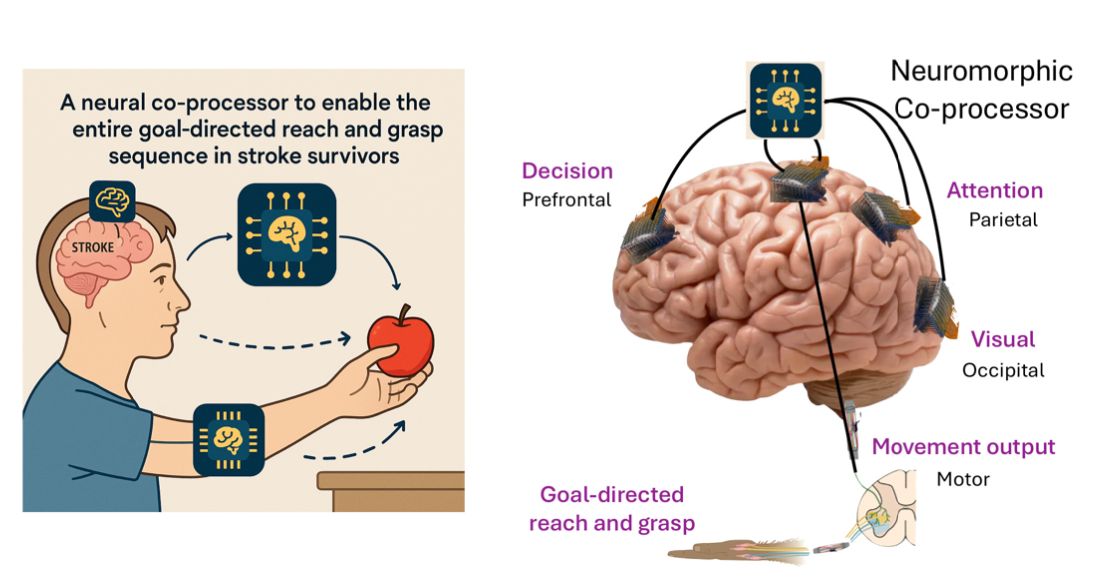 The figure demonstrates the primary objective of the project which is to develop a neural co-processor to restore goal-directed reach and grasp abilities of MCA stroke patients