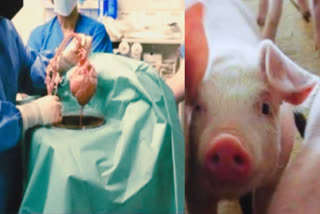 Pig kidney and liver transplanted into a human body; could pave the way for xenotransplantation in the future.