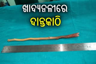 Toothpick From old Mans Esophagus