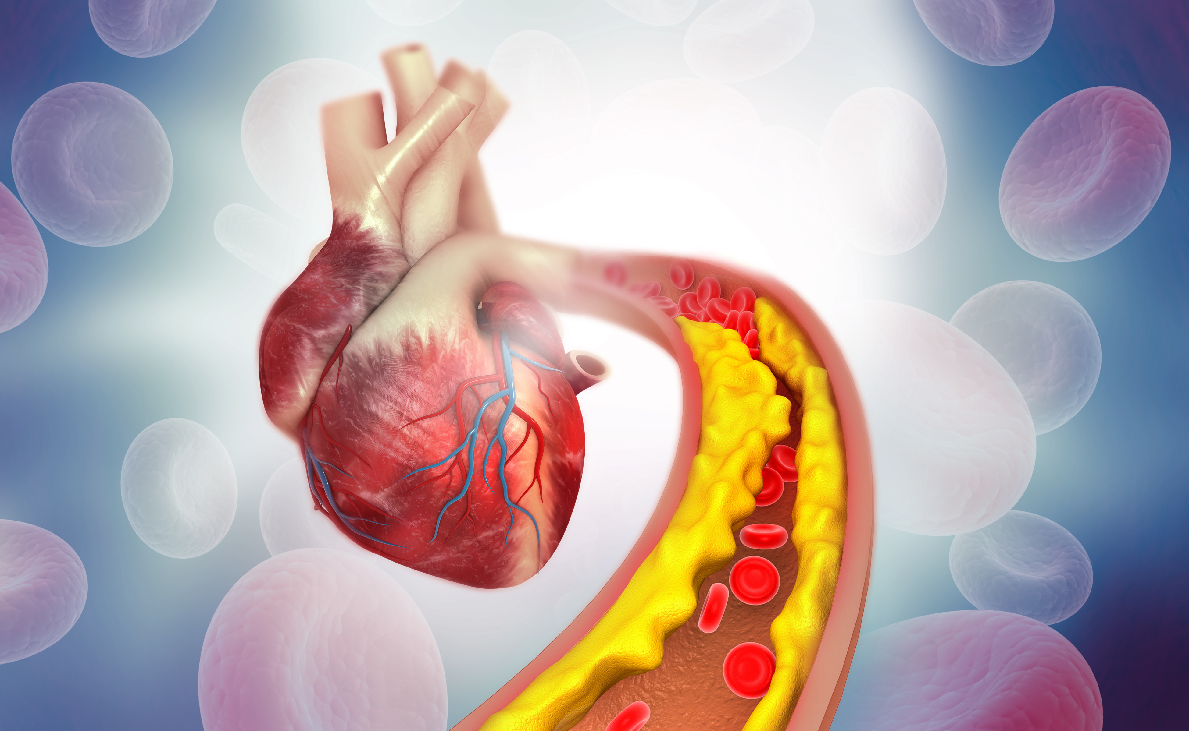 Block Arteries