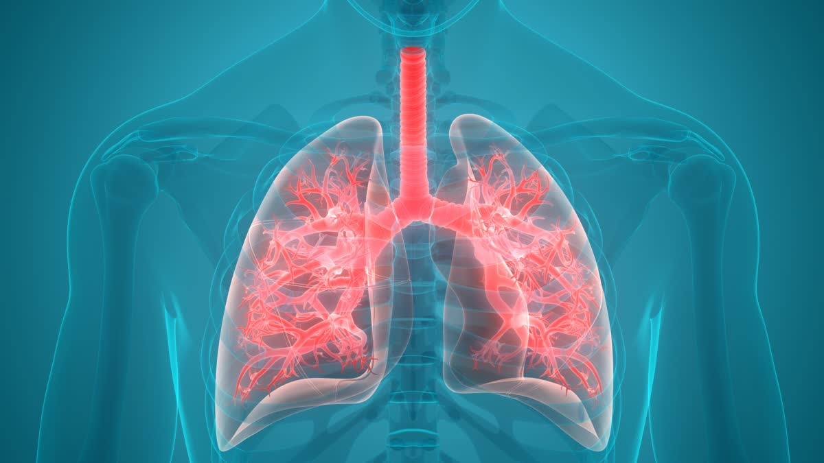 LUNG DISEASE  PROTECTING YOUR LUNGS  AIR POLLUTANTS DAMAGE LUNGS  UNG HEALTHY FOODS