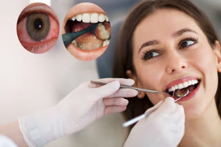 Does wisdom tooth removal really lead to loss of eyesight? Learn what experts sa