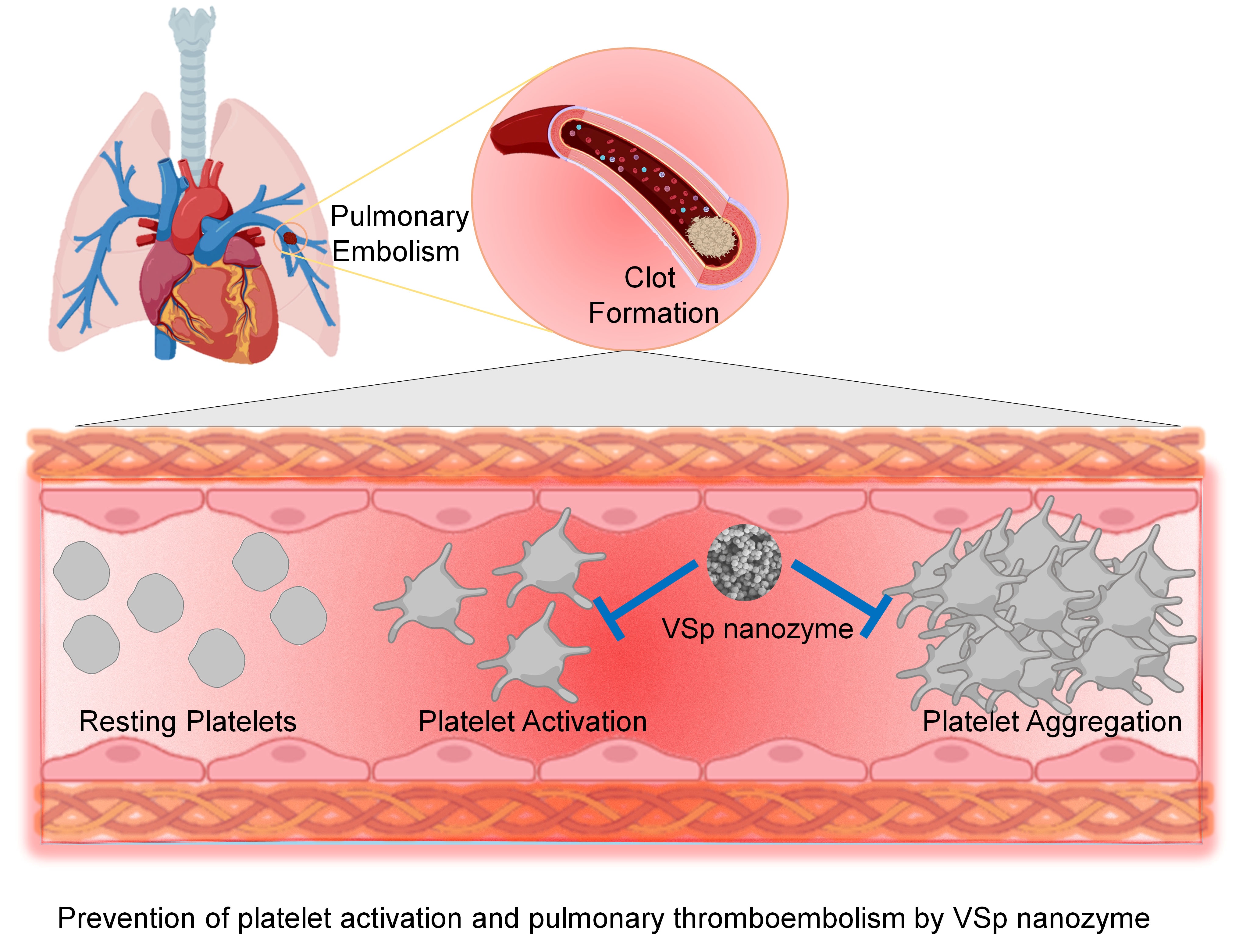 Nanozyme Breakthrough Offers Hope Against Thrombosis And Stroke