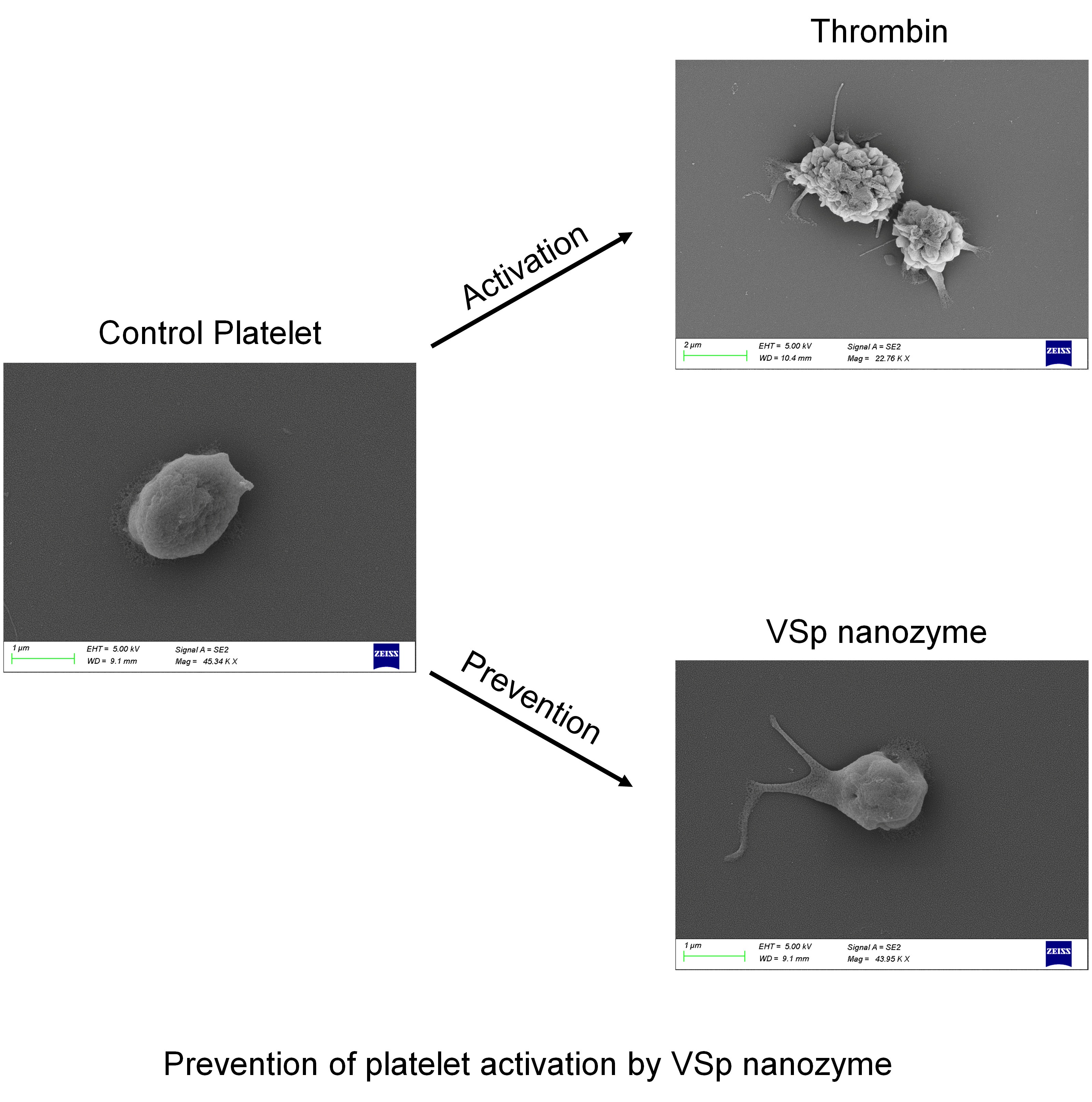 Nanozyme Breakthrough Offers Hope Against Thrombosis And Stroke
