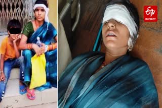 Photo Credit- ETV Bharat