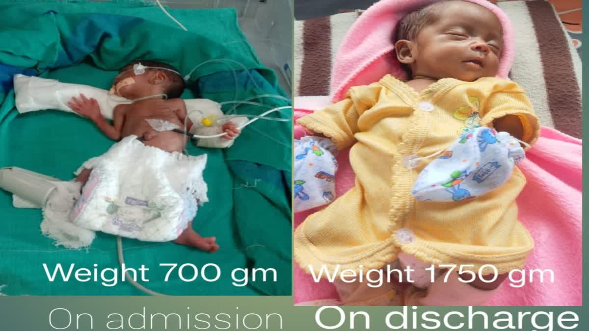 The doctors of the district hospital in Naxal-affected Bijapur saved am extremely low birth weight newborn with the best possible treatment at the Neonatal Intensive Care Unit (NICU).