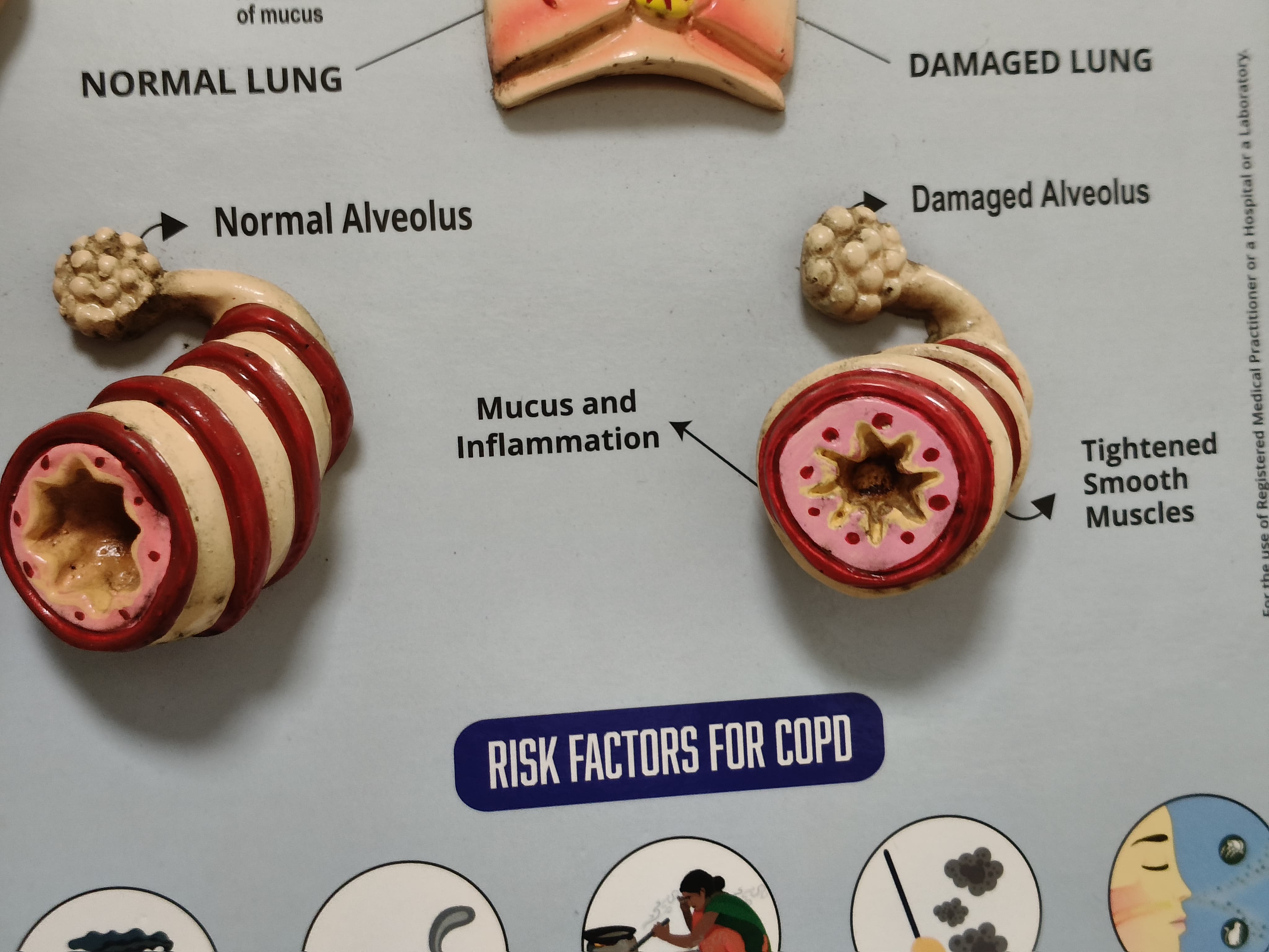 દિવાળી અને શિયાળામાં અસ્થમાનો વધતો પ્રકોપ: કારણો, લક્ષણો અને બચાવના ઉપાયો