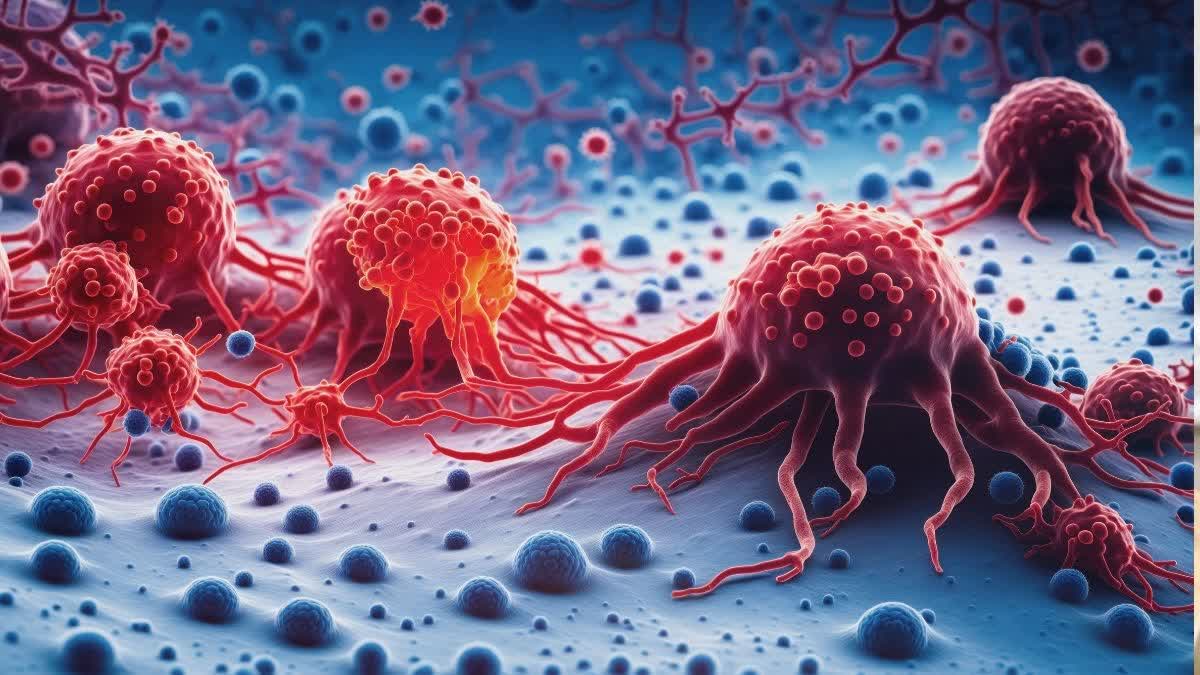 CANCER TREATMENT  CORPORATE SOCIAL RESPONSIBILITY  KOTAK MAHINDRA PRIME LIMITED