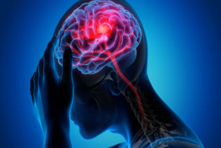 Transient Ischemic Attack