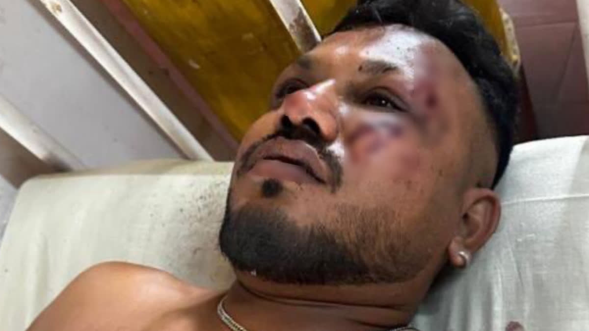 British National Viswashkumar Ramesh Only Survivor In Ill-Fated Aircraft Crash So Far