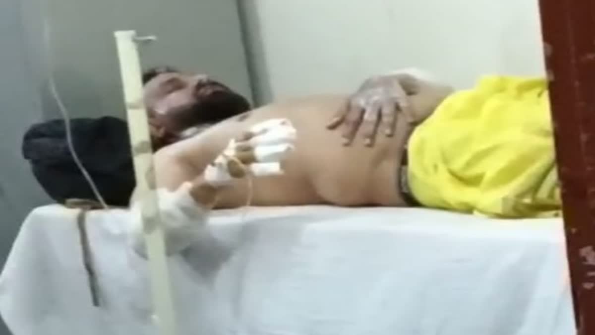 हवन कुंड में गिरने से झुलसा श्रद्धालु