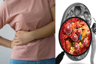 These 6 tests can tell whether your kidneys are about to fail or how your kidney health is.