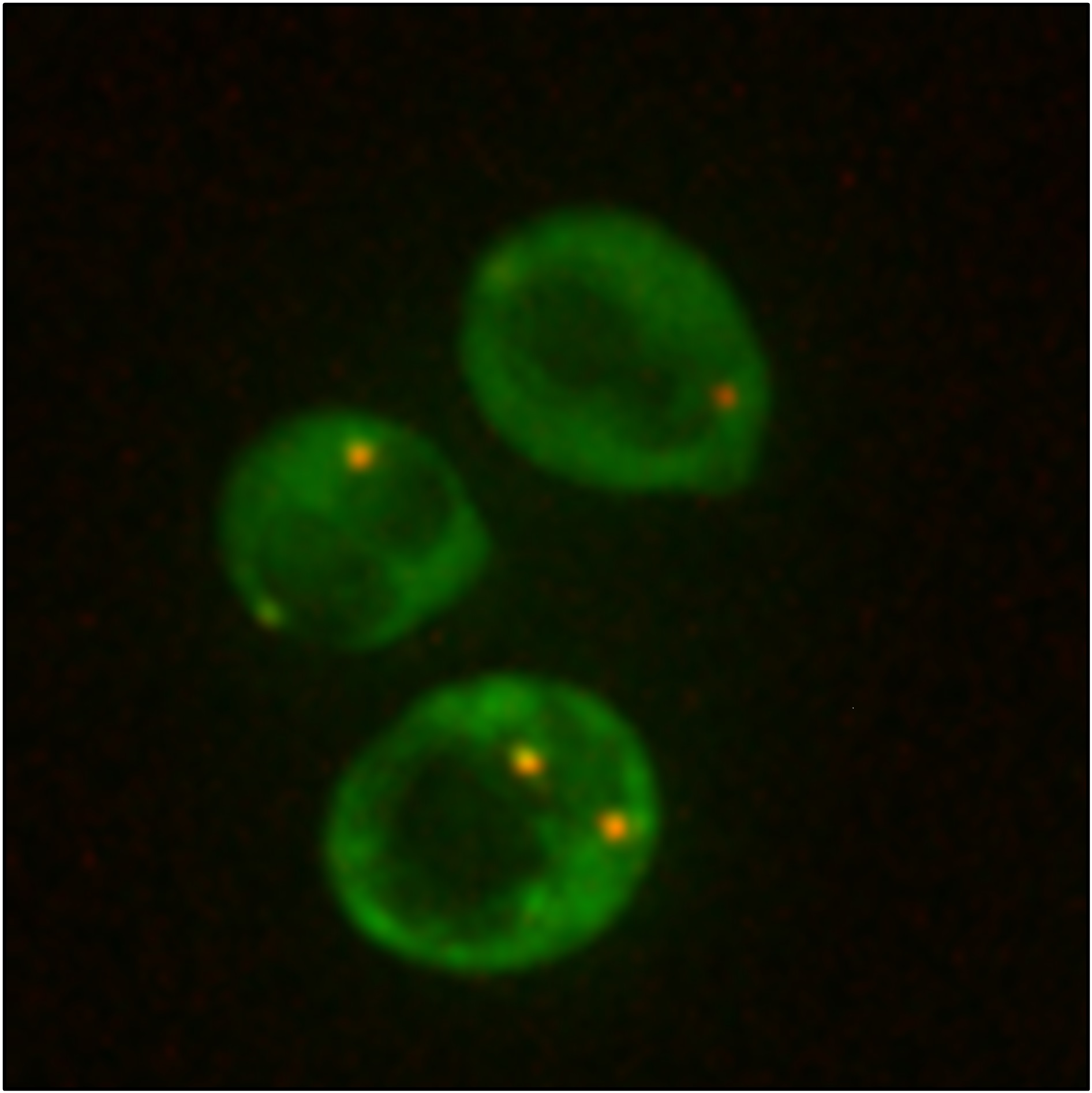 Assembly of cytoplasmic RNP condensates (yellow dots) in yeast cells in response to stress