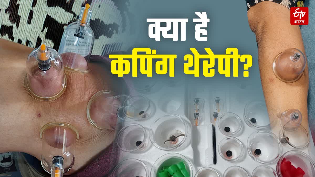 AYURVEDIC CUPPING THERAPY TREATMENT