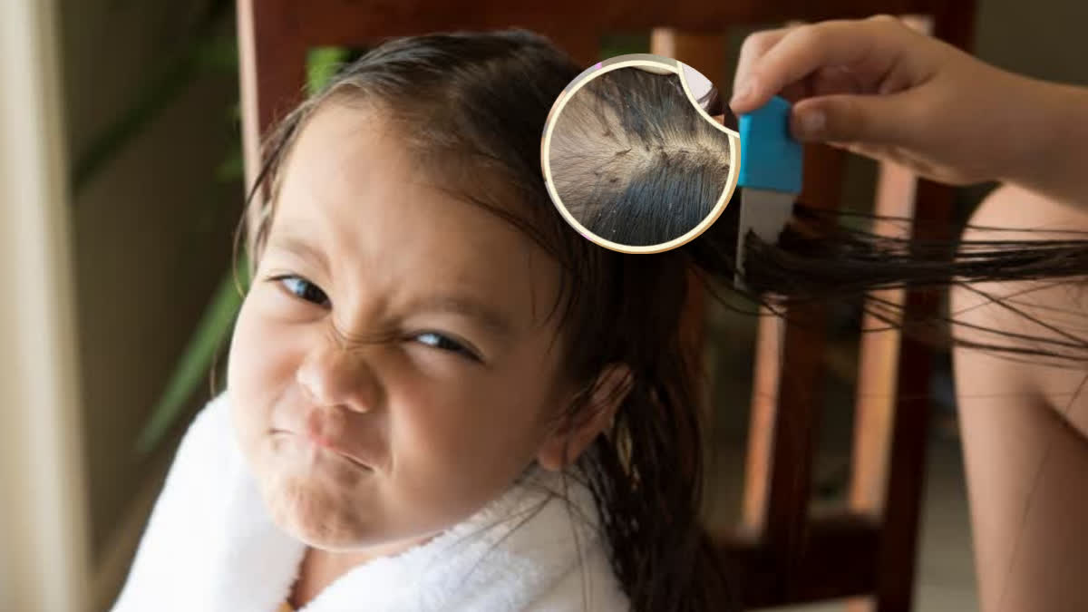 GIRL DEATH DUE TO LICE