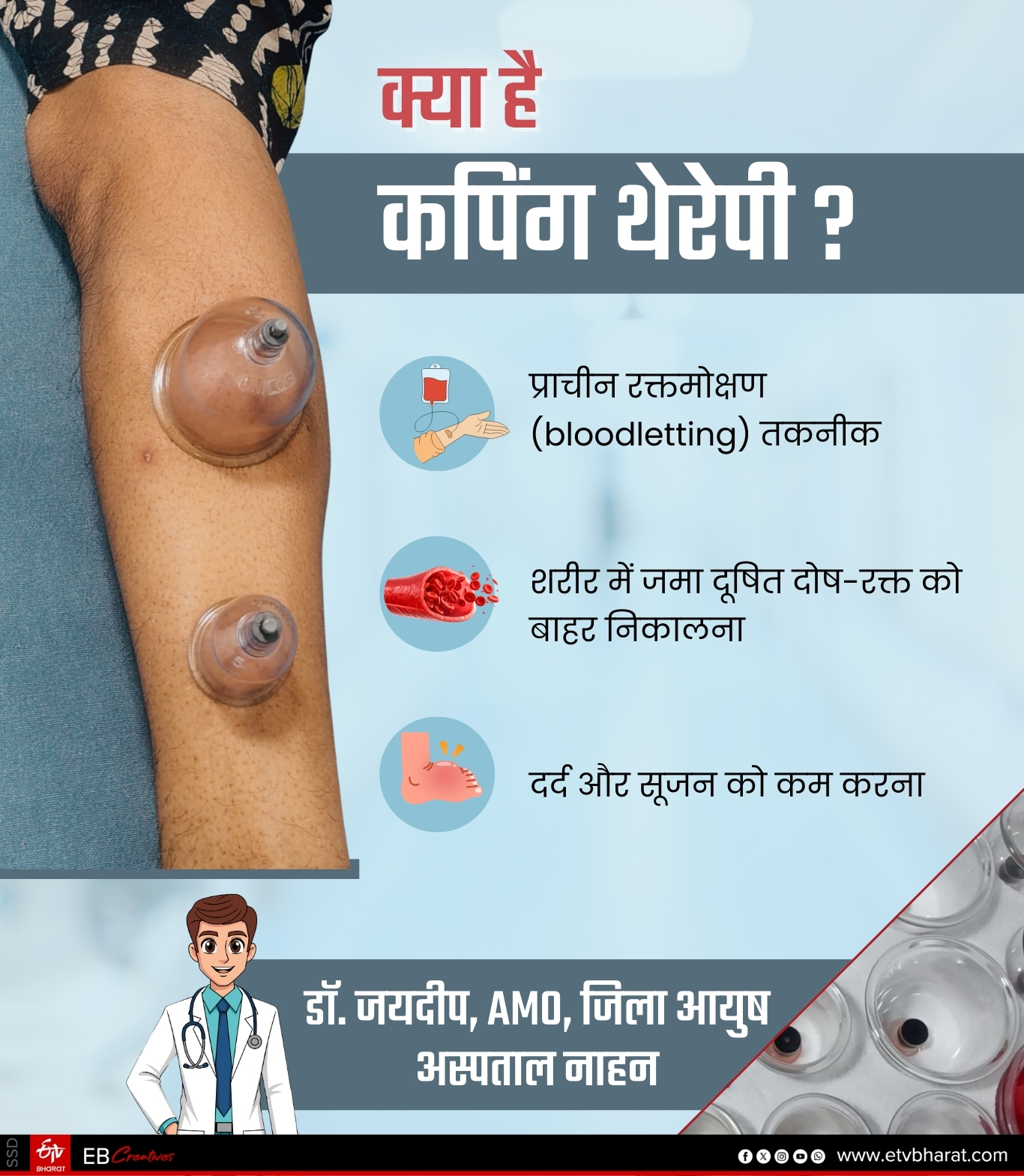 AYURVEDIC CUPPING THERAPY TREATMENT