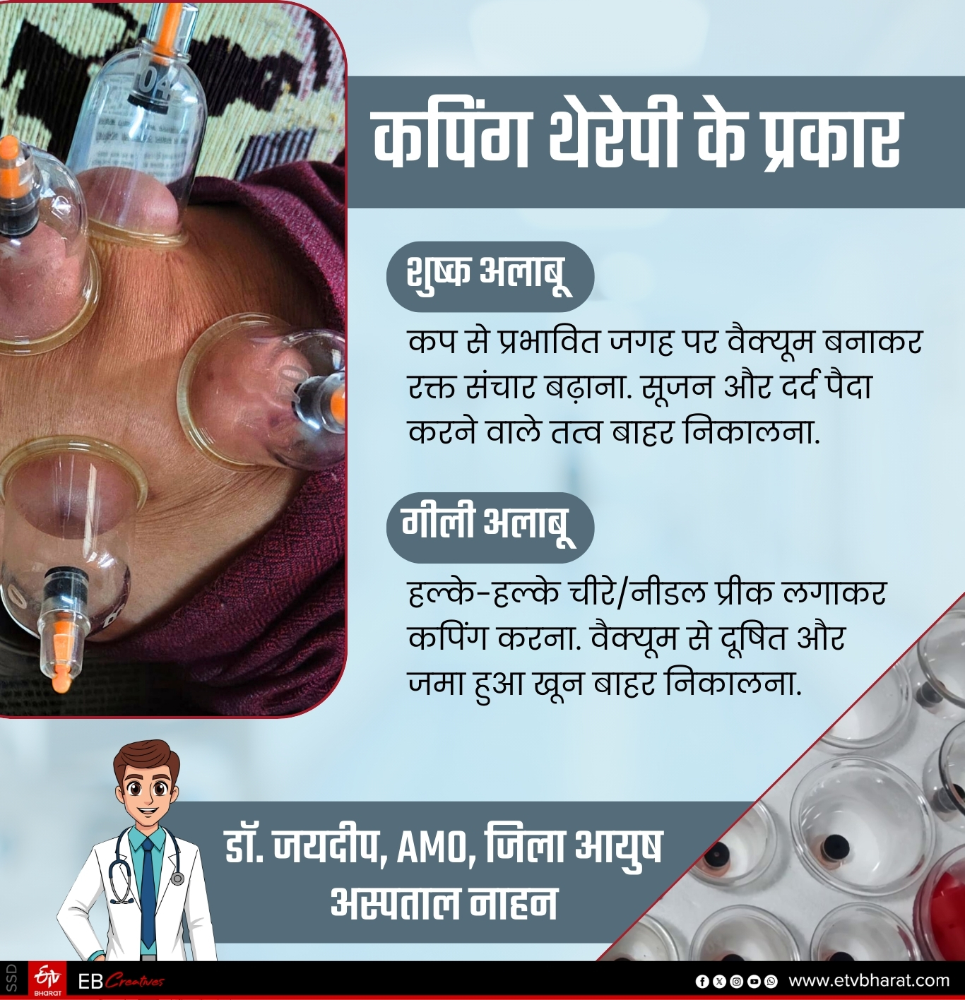 AYURVEDIC CUPPING THERAPY TREATMENT