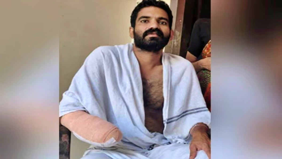 Kerala Mans Palm Amputated After Small Fish Bite Causes Rare Infection Doctor Explains Life Threatening Condition