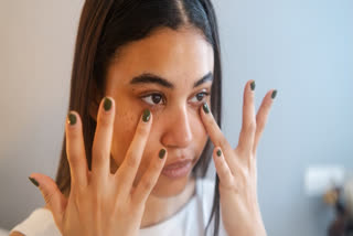 Girl with puffy face
