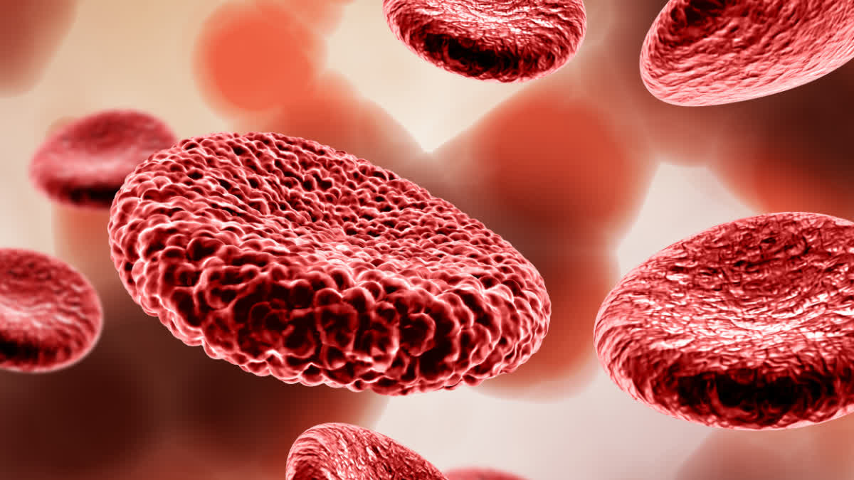 Hemoglobin Deficiency