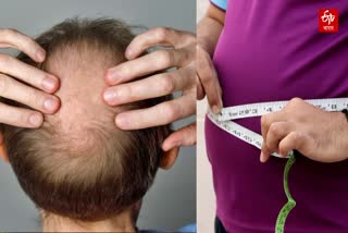 Hair loss in Men