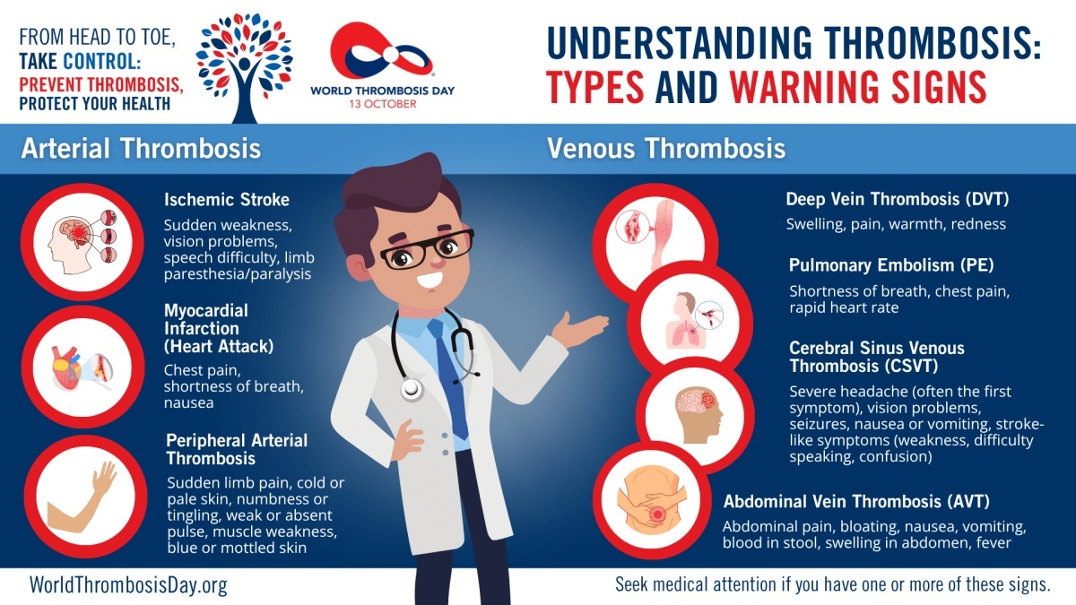 Thrombosis illustration