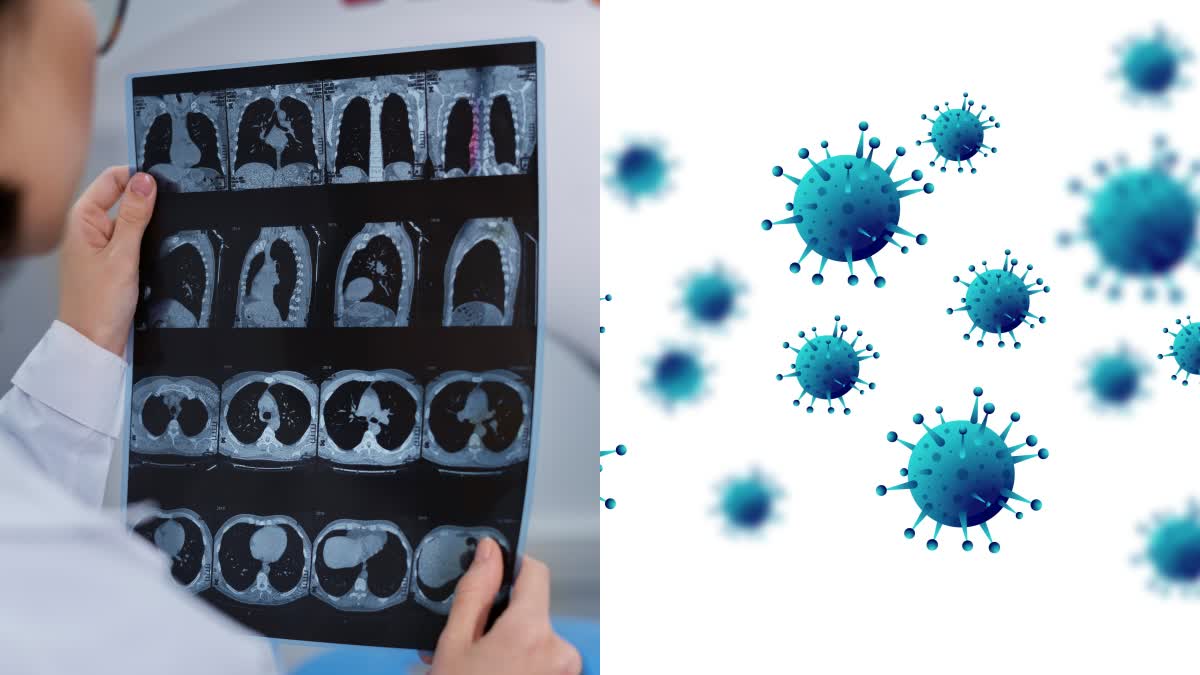 Bacteria: The New Cancer-Fighting Allies? How They Target Tumors Without Harming Humans