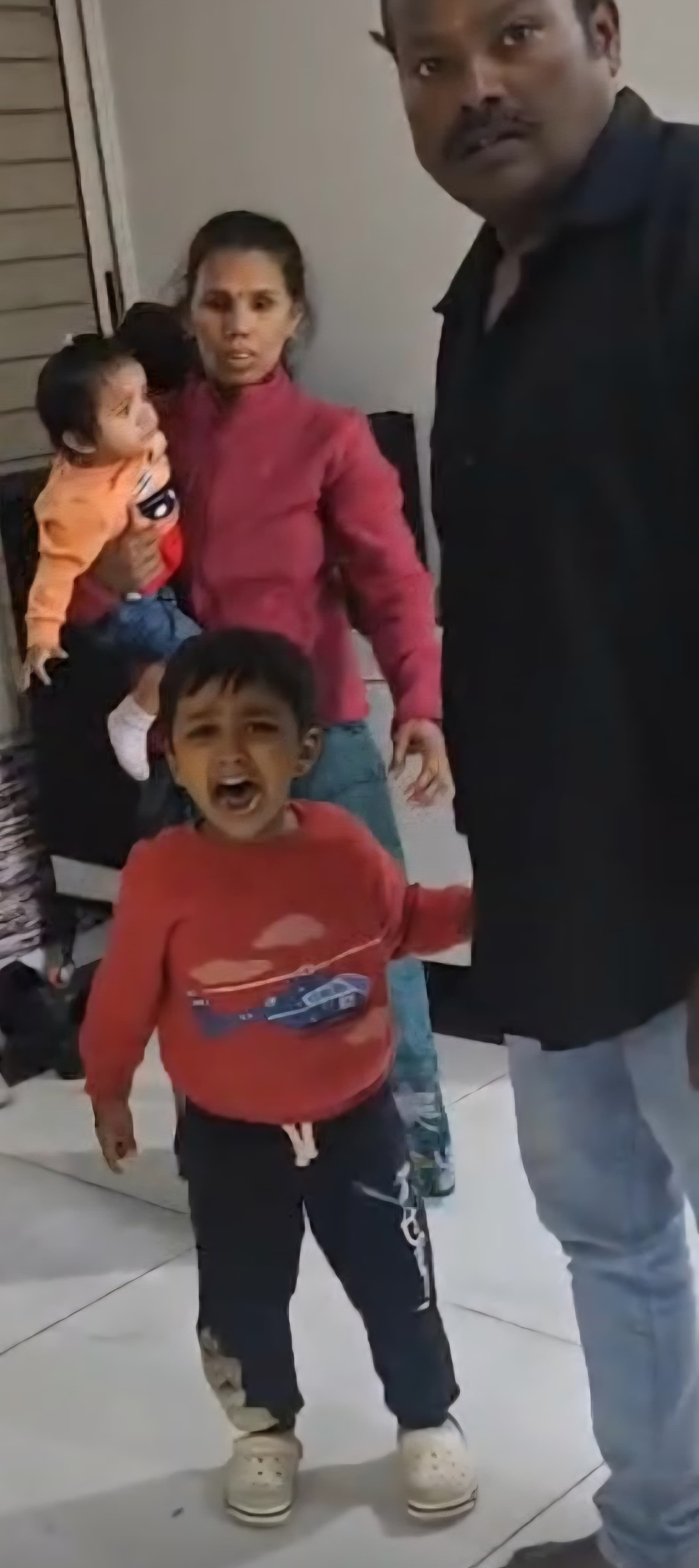 INDORE PET DOG BITTEN CHILD