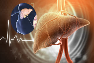Eating healthy food can also cause fatty liver disease, expert explains in detail how?