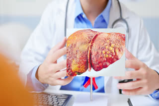 Early signs of fatty liver appear on the face, know which type is more dangerous