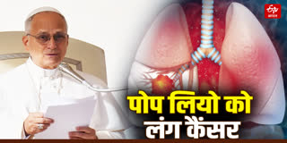 पोप लियो 14वें के फेफड़े में कैंसर की पुष्टि